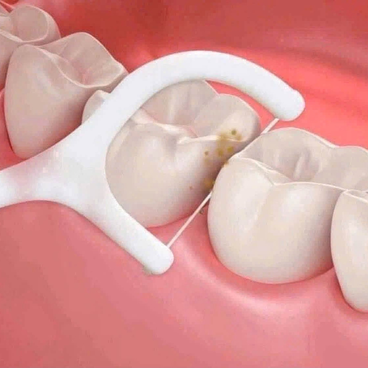 Hộp 88 chiếc tăm chỉ nha khoa để bàn tự động MyLan